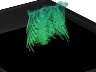 Opto Engineering, Matrix Imaging Partner for Machine Vision Collaboration